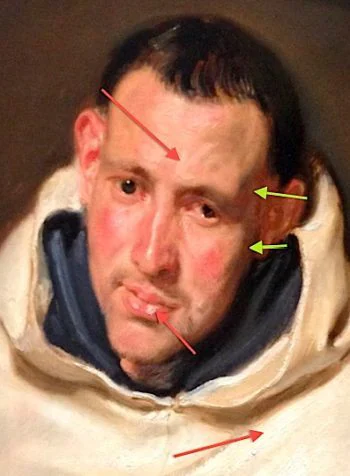 Detail of the Van Dyck portrait with arrows marking thin dark areas and thick light areas